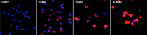 A sequence of images showing multiple myeloma cells internalizing the engineered nanoparticles